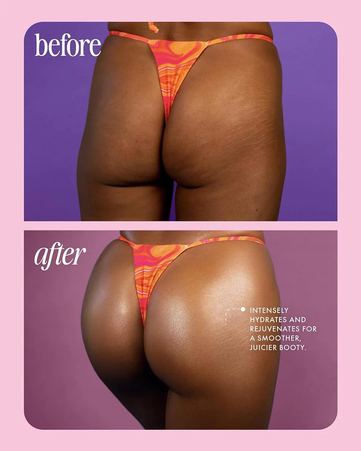 Buns Of Glowry Tighten &amp; Glow Butt Sizeerum